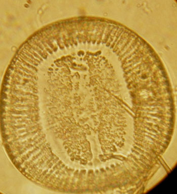Image of diatom