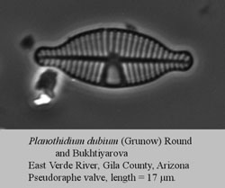 Planothidium dubium