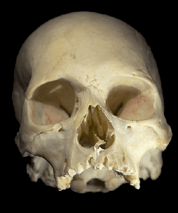 Human Skull