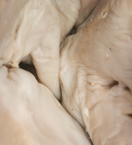 Inferior view of the cusps of the aortic valve