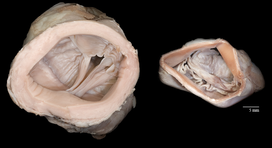 Size comparison of bovine and porcine aortic valves