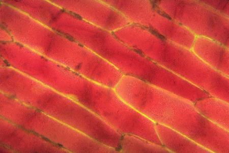 onion epidermal cells under microscope