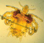 Pubic louse