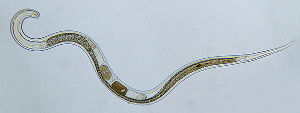 tapeworm under a microscope