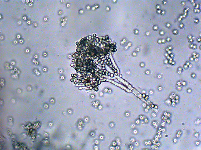 fungi microscope slides