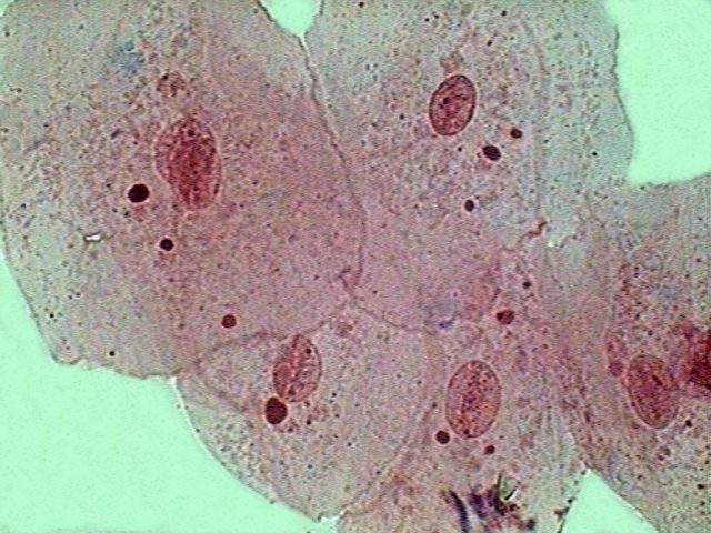 eosin stained