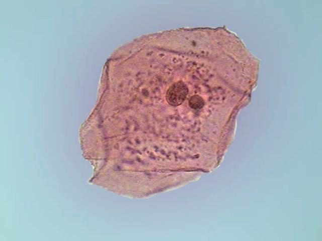 another cell