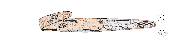 spirostomum