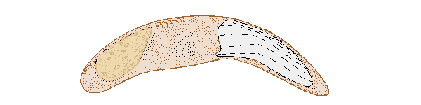 spirostomum