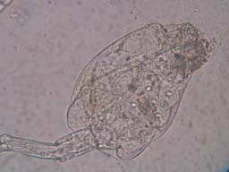 Rotifer (Scaridium)