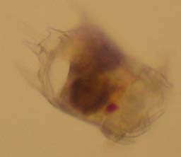 Rotifer (Brachionidae?)