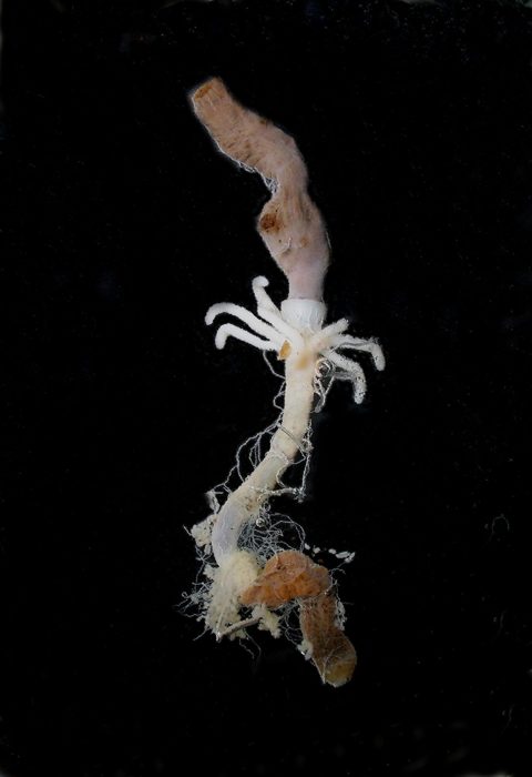 digestive system 06 - parasites 3