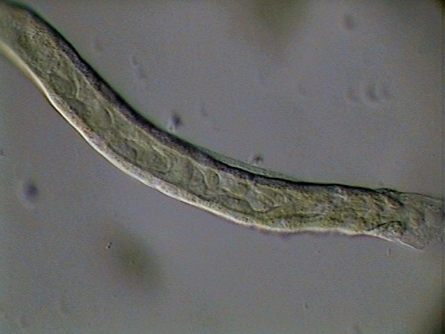 malpighian tubule 09 - parasites 3