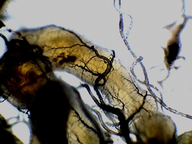 intestine and tracheae 10 - parasites 3