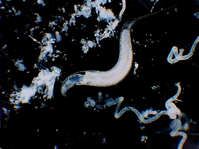 nematode 112 - parasites