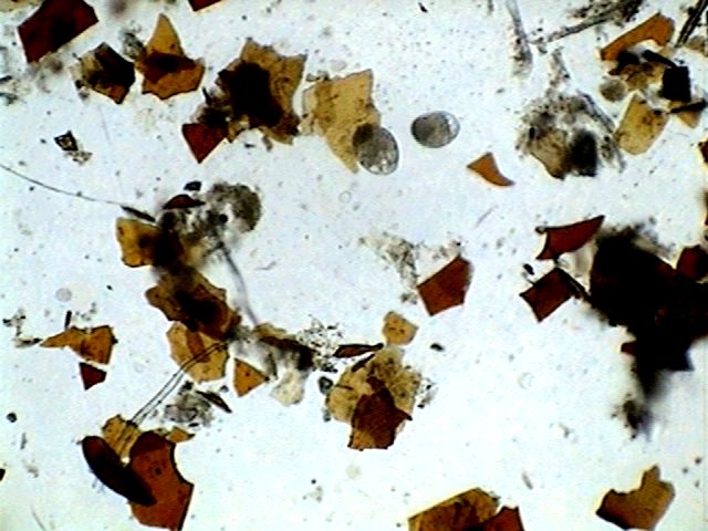 nyctotherus 113 - parasites 3