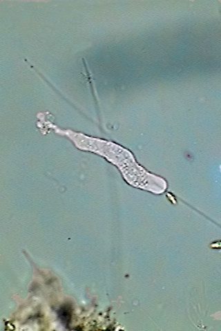 limax type amoeba 12 -parasites 3