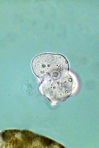 anchored amoeba 14 - parasites 3