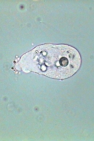 floating amoeba 15 - parasites 3