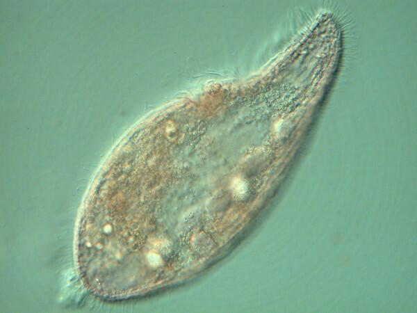 These protists could never be presented as examples of a typical ciliate.