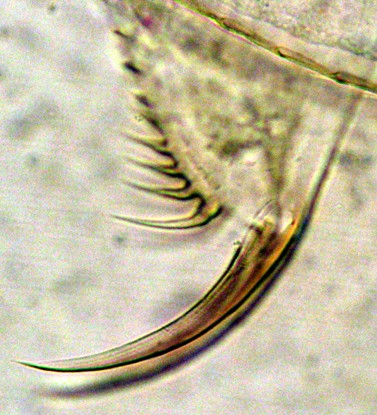 Daphnia rosae claw 100X