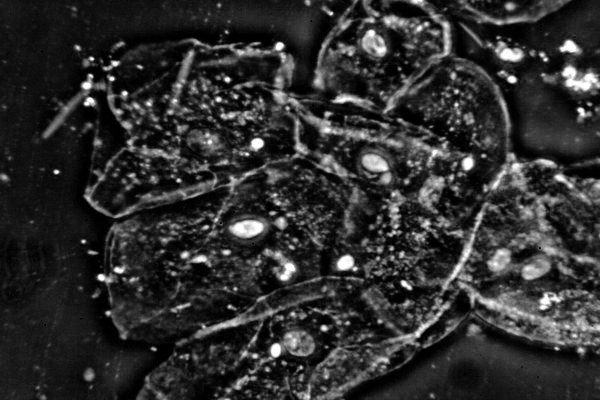 Epithelial cells LOMO microscope HTR 40x bright