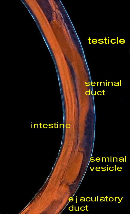 male system, labels