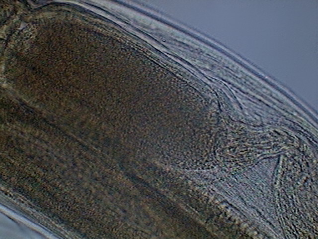 seminal vesicle