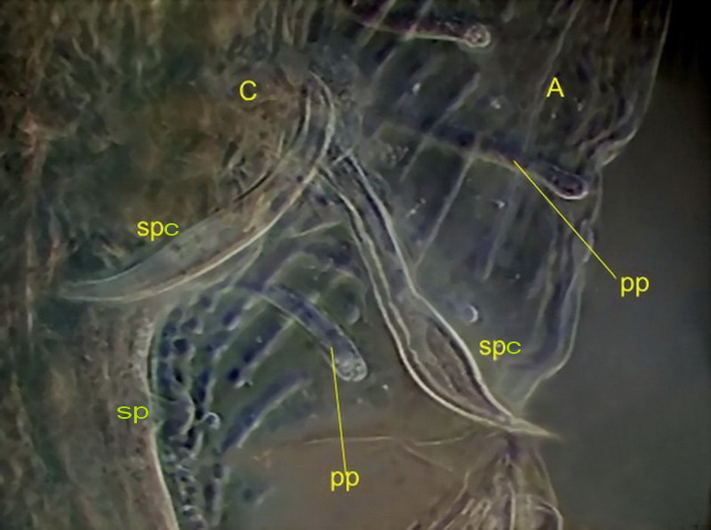 cloacal complex