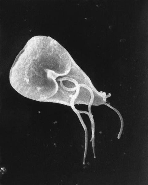 Giardia SEM image - creative commons
                        licence - wiki