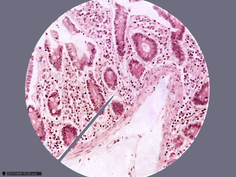 02 - Aamalgamation result