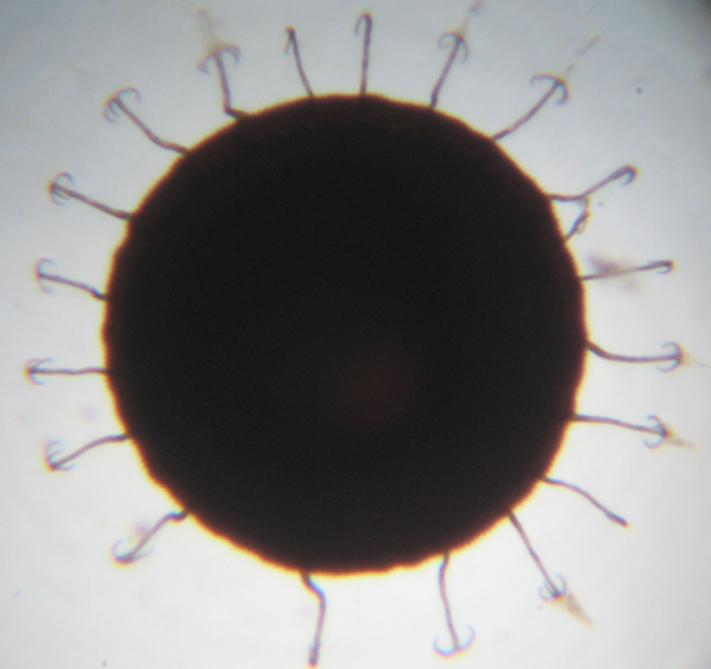 Cristatella mucedo statoblast through a microscope