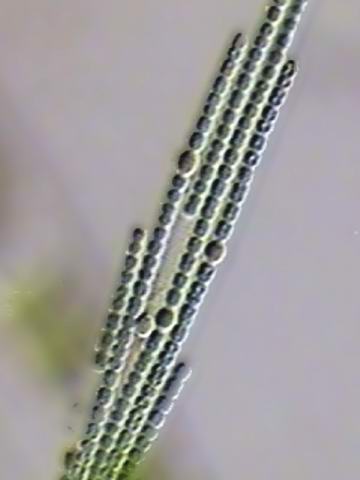 anabaena