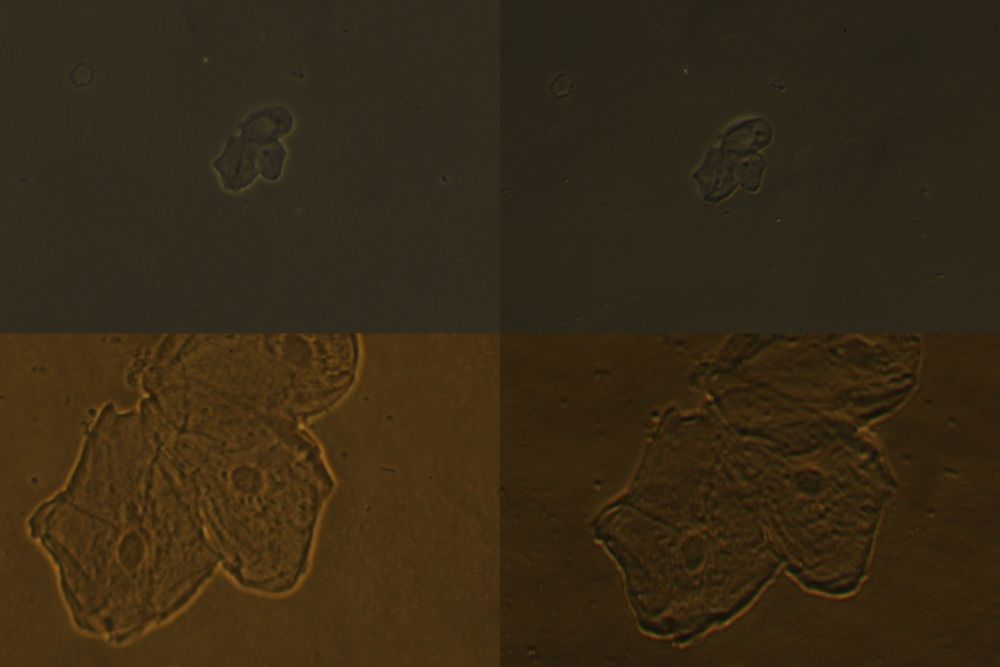 comparaison phase et relief phase contrast