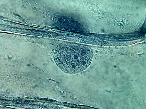 8a - acetic 100x