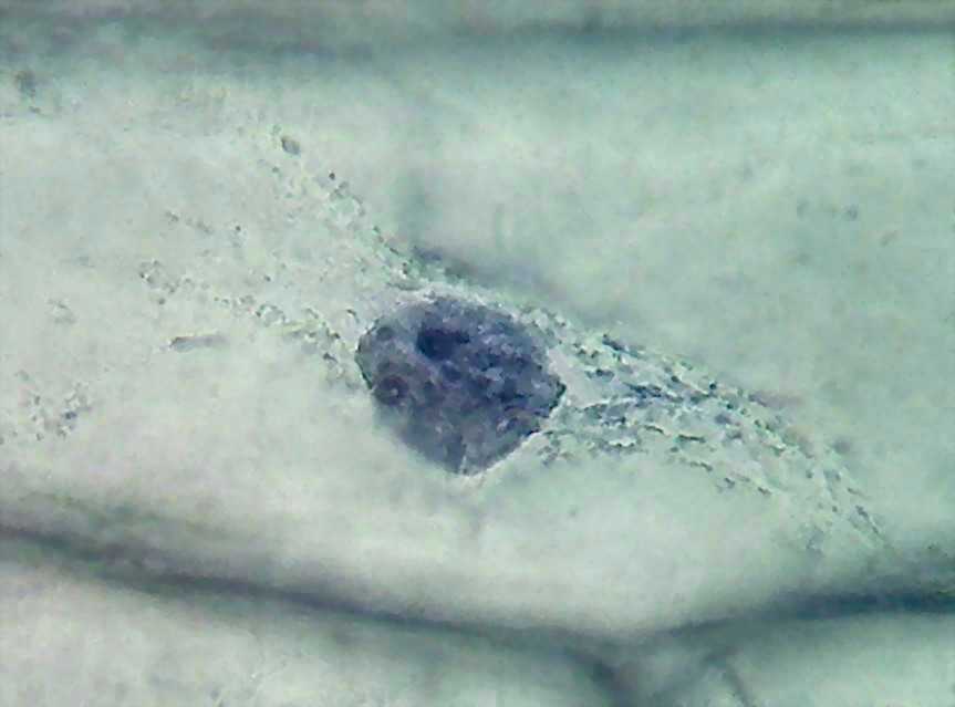 100x - broken cytosol