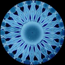 Diatoms