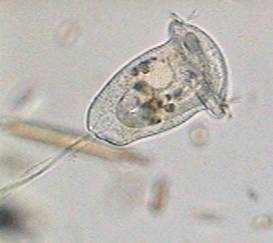 vorticella convalaria