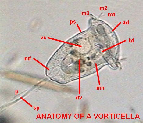 labled vorticelle