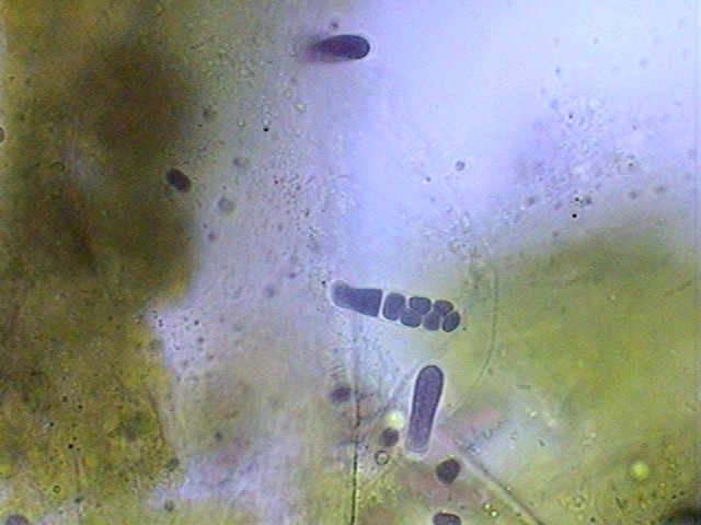 Chamasiphonaceae Parasitos 1 -fig 011