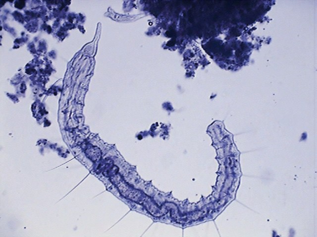 fig 1- naidido parasitos 1- 001