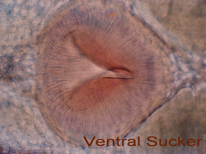 ventral sucker