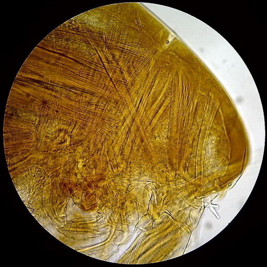 diaptomid head