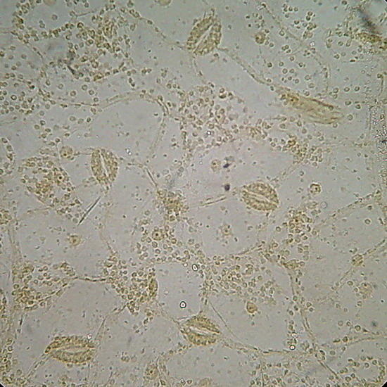 GLG- epidermis 1