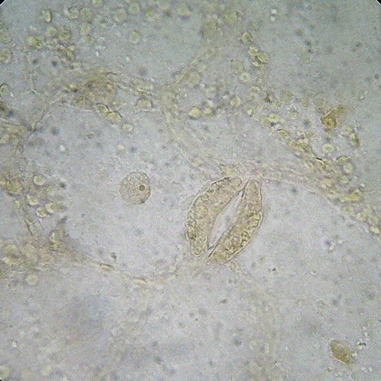 GLG epidermis 2