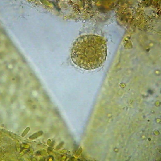 heliozoa