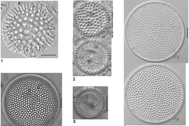 Norland mounted diatoms