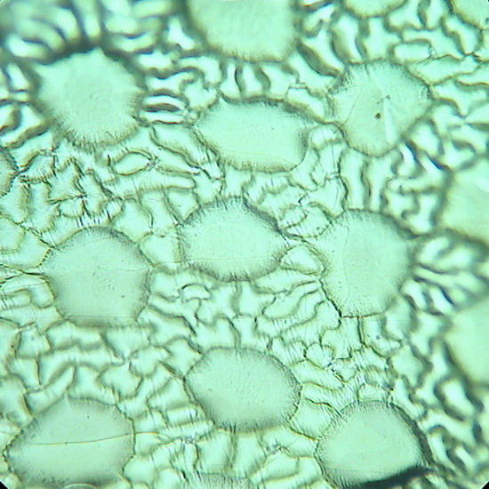 bladder cells, Aptenia