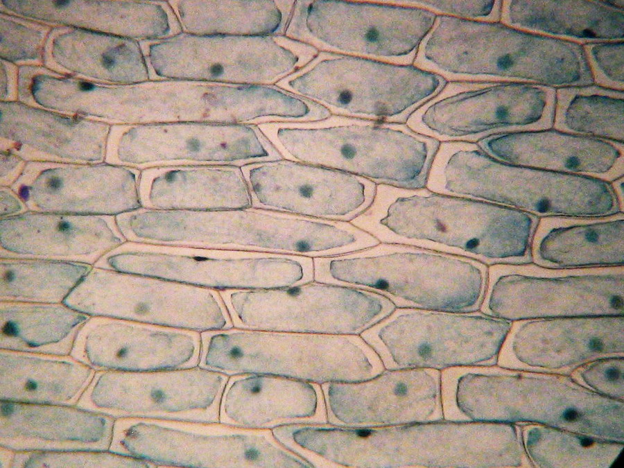 plasmolysis