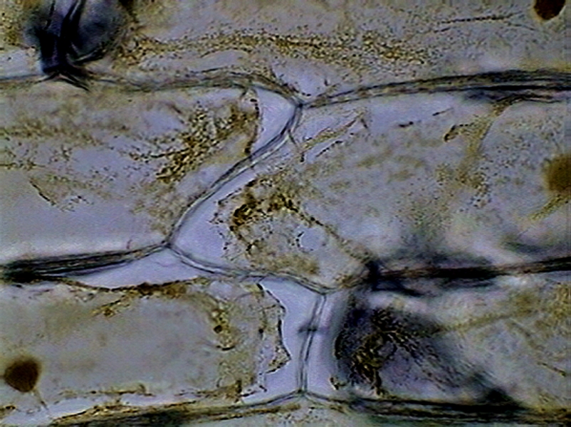 plasmolysis 2